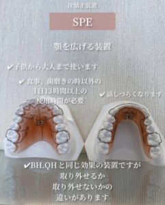 SPE