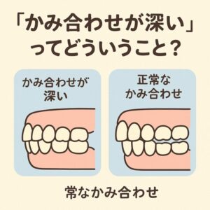 かみ合わせ深い