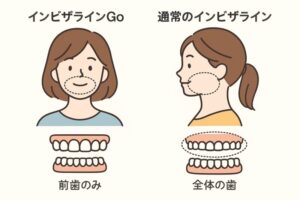 インビザGO