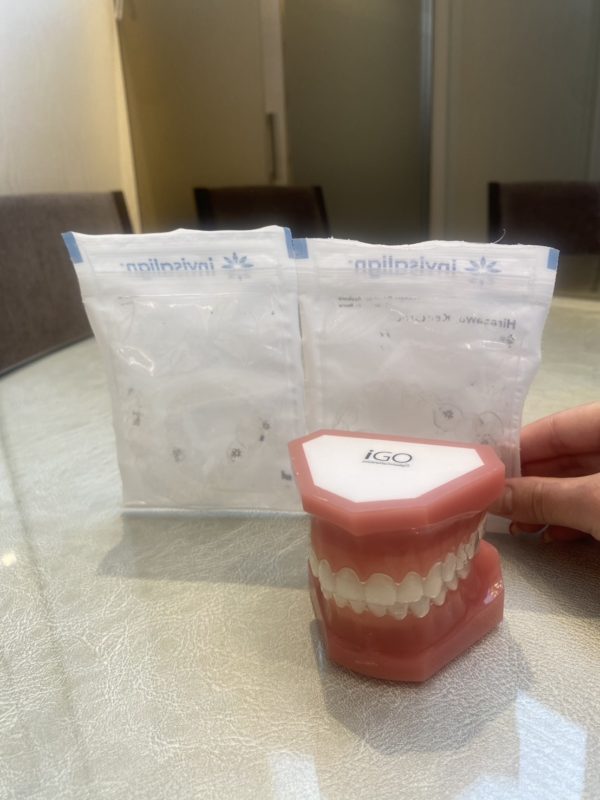 インビザライン矯正