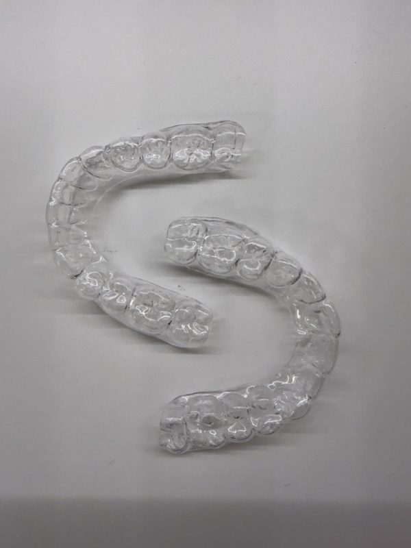 ソフトリテーナー